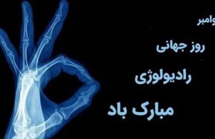8 نوامبر مصادف با 17 آبان ماه سالروز کشف اشعه ایکس که با عنوان روز رادیولوژی نامگذاری شده است؛ گرامی باد. این روز را به کلیه متخصصان و تکنیسین های رادیولوژیست تبریک می گوییم. ═════❁&#x1f4a0;❁═════کانال جدید خبری تلگرامی سازمان نظام پزشکی نیشابور:https://t.me/nezamneyshabourr